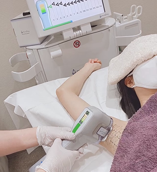 ミラドライ照射
