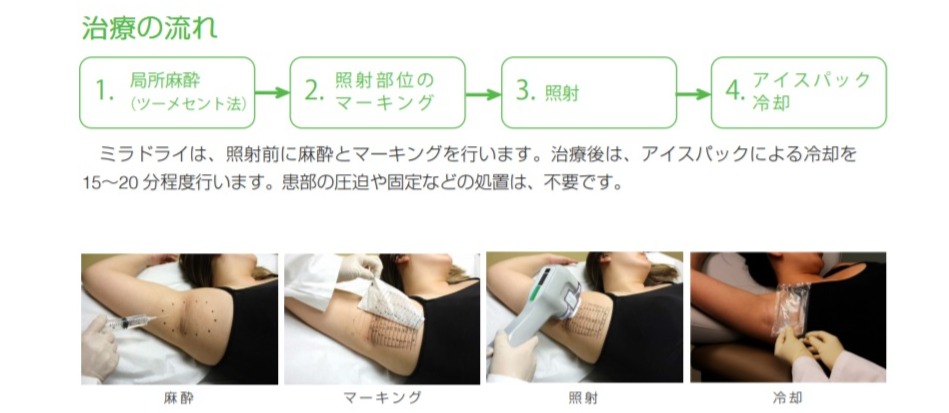 ミラドライ　メーカー推奨のアップデートされた方法での施術