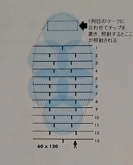 ミラドライ １照射で照射される範囲　CLINIC N東京銀座