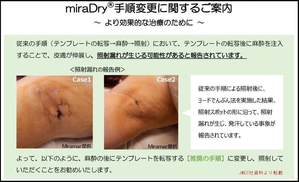 ミラドライの正しい施術法について わきが脇汗治療