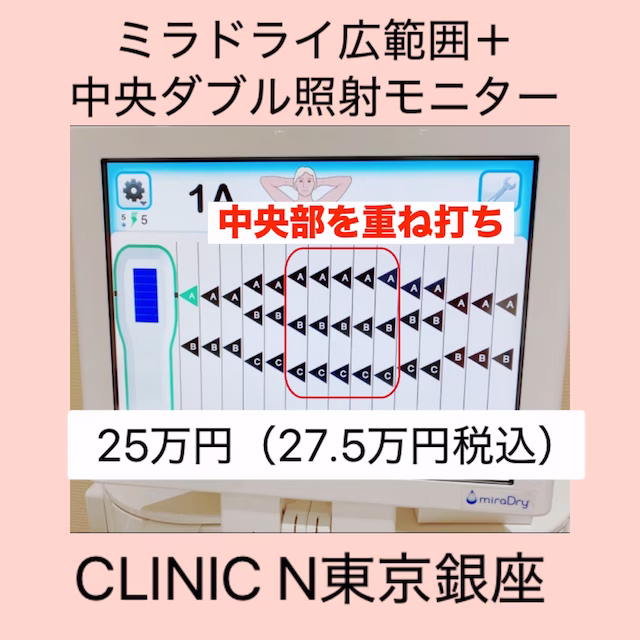 CLINIC N東京銀座5周年記念モニター告知画像。ミラドライ広範囲＋中央ダブル照射が特別価格で安く受けられるキャンペーン情報