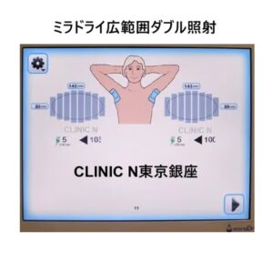 副乳モニター様照射数の画面